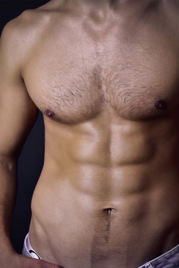 abdominal etching femme avant apres chirurgie esthetique corps dr alexandre duhoux chirurgien medecine esthetique et plastique chirurgie reparatrice antony paris