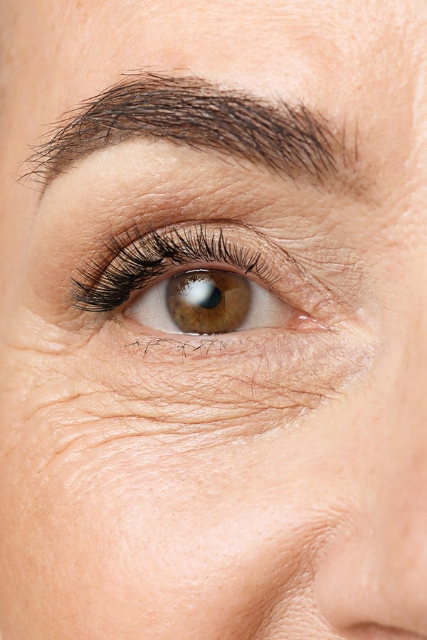 lifting sourcil paris avant apres chirurgie esthetique visage dr alexandre duhoux chirurgien medecine esthetique et plastique chirurgie reparatrice antony paris lifting sourcil paris avant apres chirurgie esthetique visage dr alexandre duhoux chirurgien medecine esthetique et plastique chirurgie reparatrice antony paris
