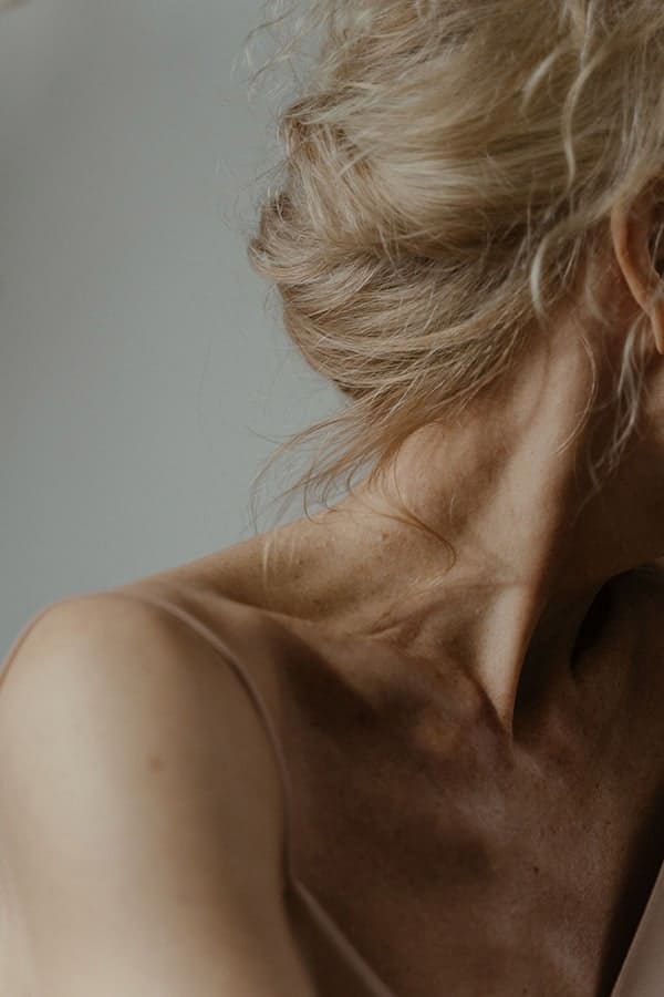 lipoaspiration cou double menton chirurgie esthetique visage chirurgie reparatrice dr duhoux medecine chirurgien esthetique et plastique antony paris