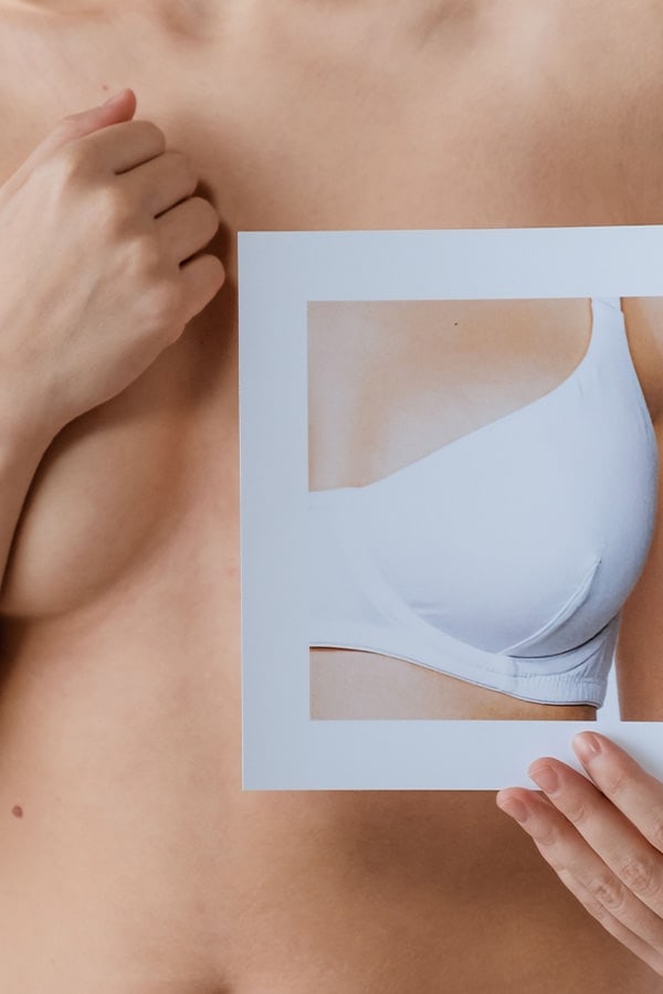 reconstruction mammaire par lambeau grand dorsal chirurgie reparatrice paris dr alexandre duhoux medecine plasticien chirurgien esthetique antony paris