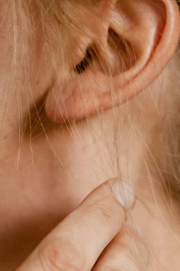 reparation lobe oreille fendu tarif paris chirurgie esthetique visage chirurgie reparatrice dr duhoux medecine chirurgien esthetique et plastique antony paris reparation lobe oreille fendu tarif paris chirurgie esthetique visage chirurgie reparatrice dr duhoux medecine chirurgien esthetique et plastique antony paris